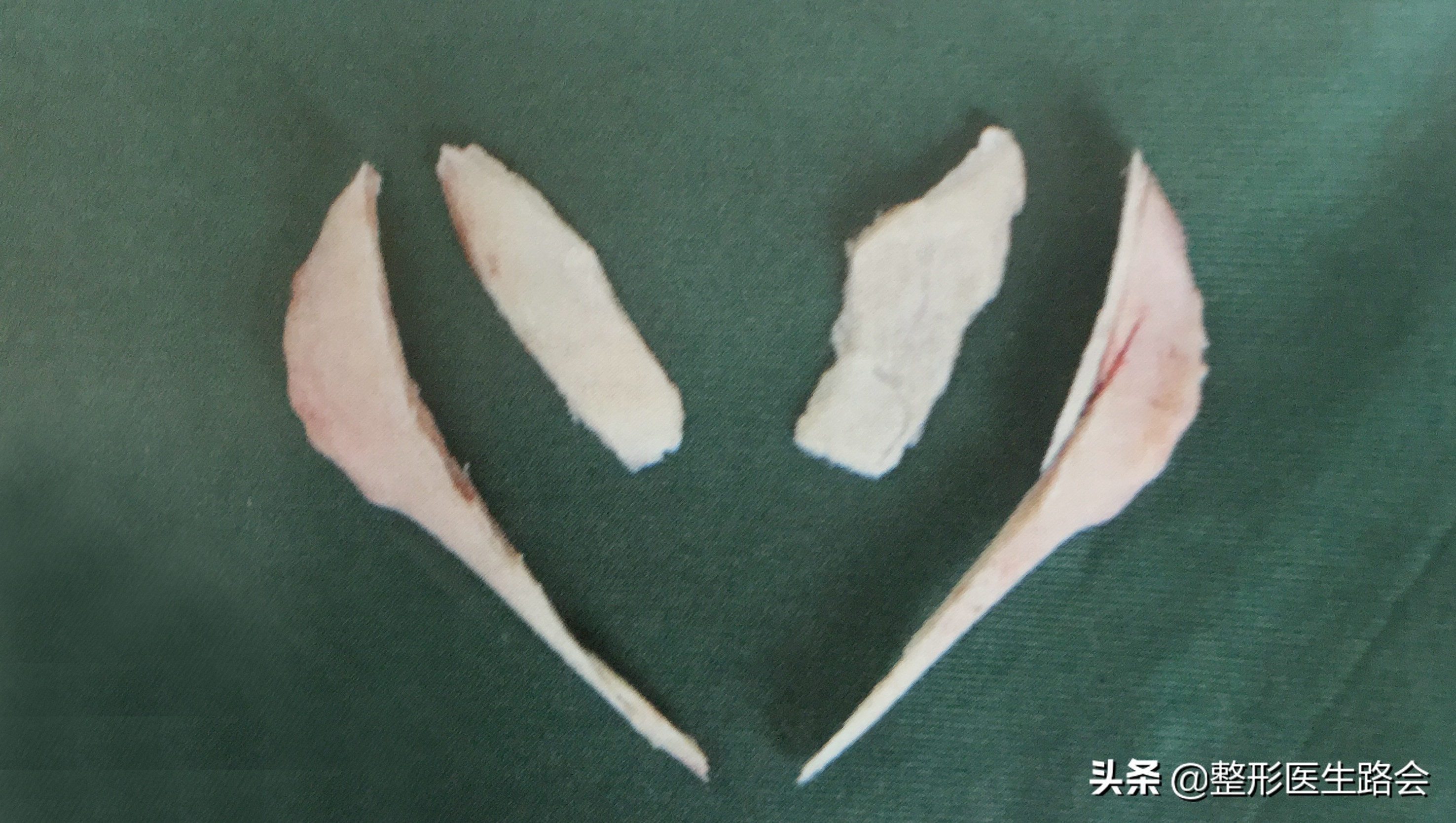 怎样看侧脸才是真实的侧脸,侧脸怎么样才算好看