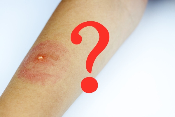 如何正确看待转基因技术和产品？谈“转”色变不应该