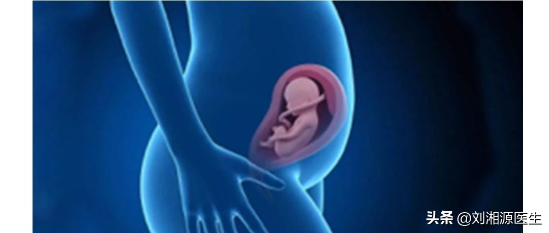 免疫不良妊娠怎么处理,免疫治疗不良妊娠的方法