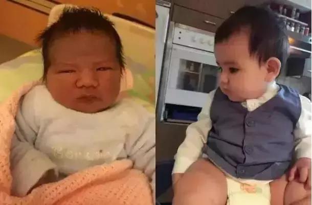 新生儿10天没有鼻梁怎么办,新生儿没有鼻梁山根