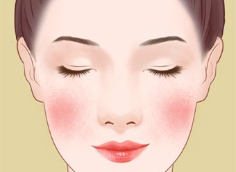 血丝多怎么办,红血丝怎么能消除