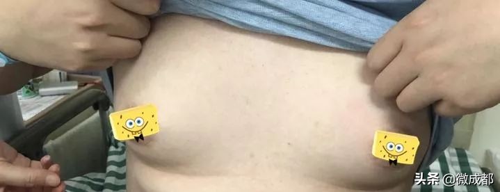 男性泌乳素型垂体大腺瘤严重吗,男人得了泌乳素垂体瘤严重吗