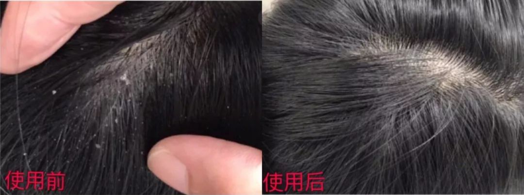 明星亲测有效的护肤品,明星亲测