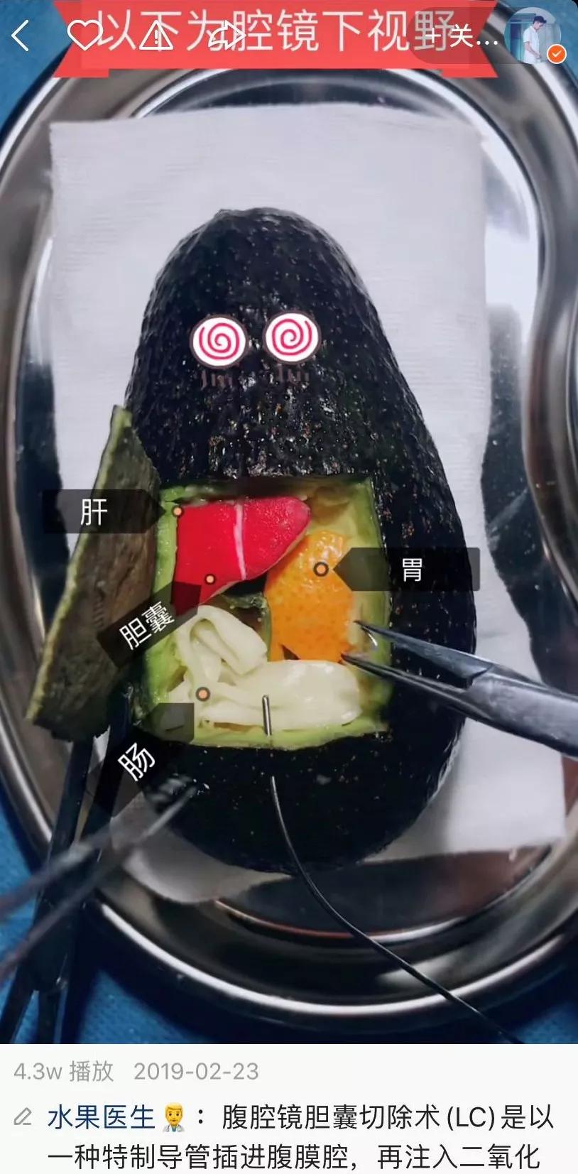 我在快手上看人切洋葱，竟然弄懂了剖腹产？