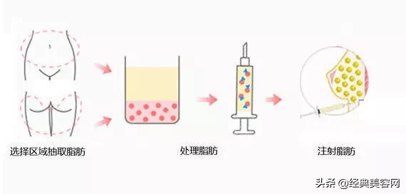 平胸丰胸最有效的方法,丰胸怎么学