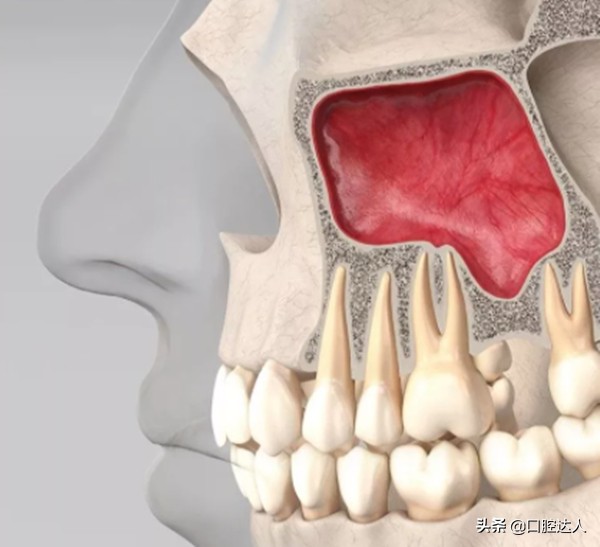 一直犹豫种不种牙，有什么建议吗？