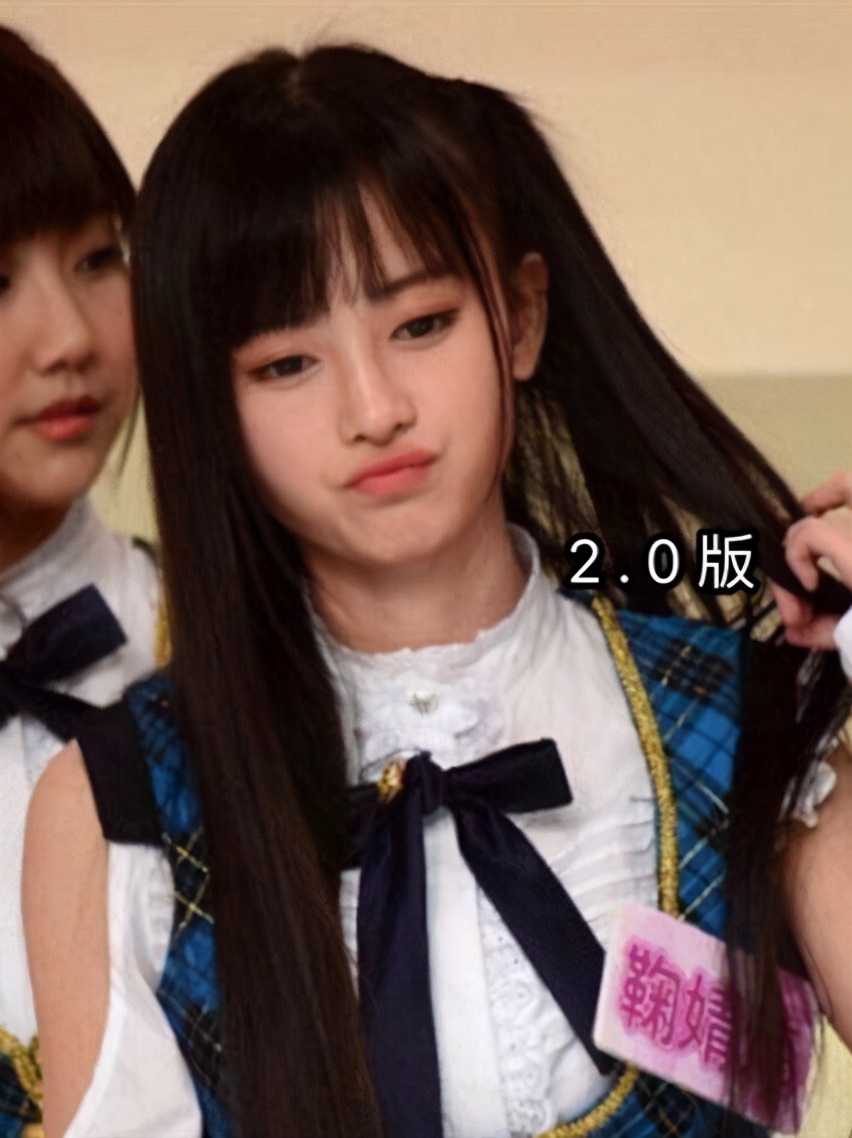 男生隆鼻很假,软骨隆鼻假吗