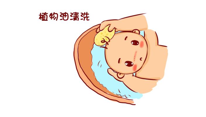 4个月宝宝头皮乳痂反复起怎么办,婴儿头皮乳痂能去除吗