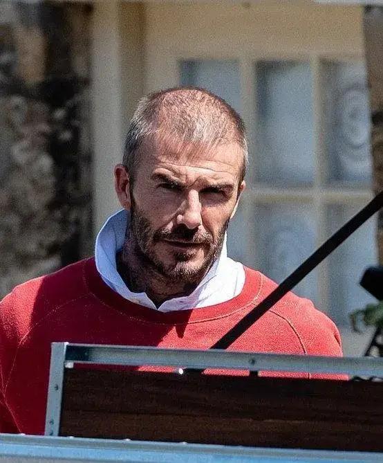 脱发的英语介绍,脱发英文名