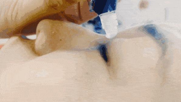 眼疲劳是用护眼贴还是蒸汽眼罩,蒸汽眼罩可以缓解眼睛干涩吗