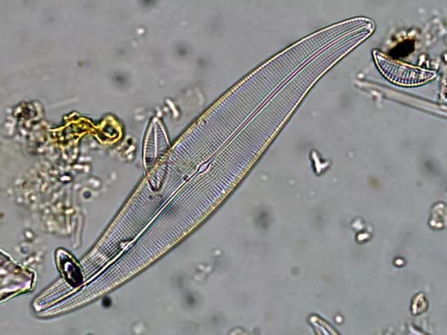 水产养殖藻类老化是怎样的,水产养殖显微镜下各种藻类