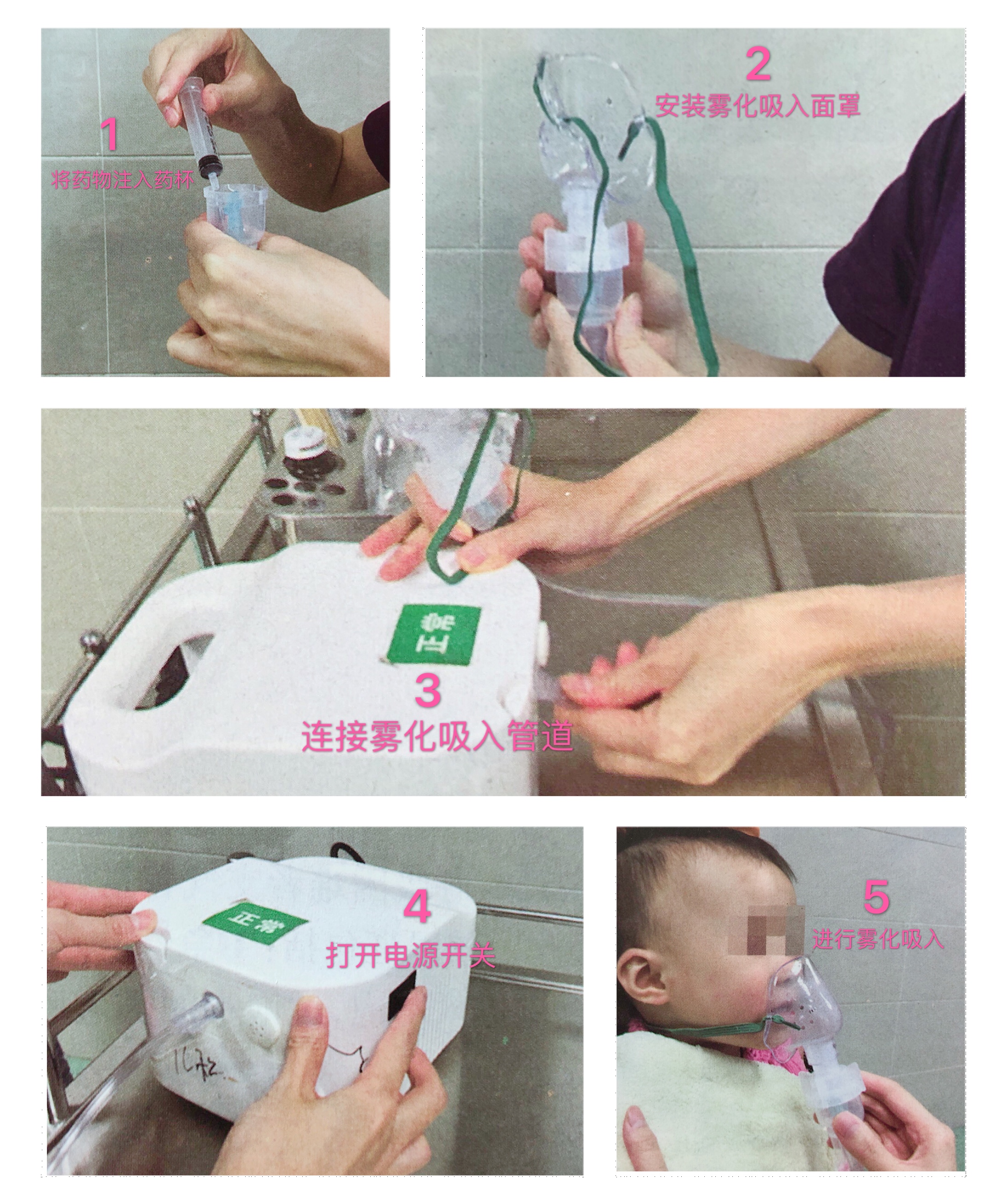 宝宝咳嗽雾化多少天能好,宝宝咳嗽做雾化对宝宝有影响吗