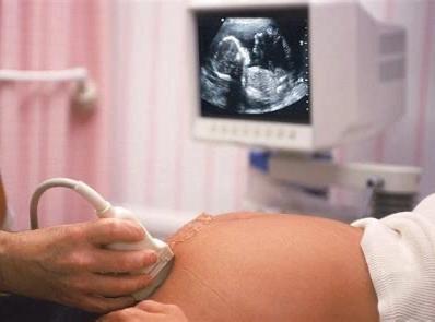 产检流程详细步骤,新手妈妈孕检全攻略