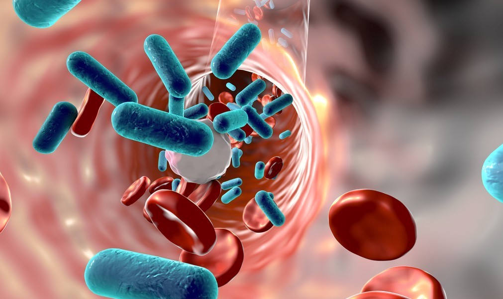 剖宫产瘢痕憩室的发病因素,剖宫产瘢痕憩室是什么