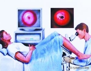 做妇检会感染hpv吗,做妇检会影响生育吗