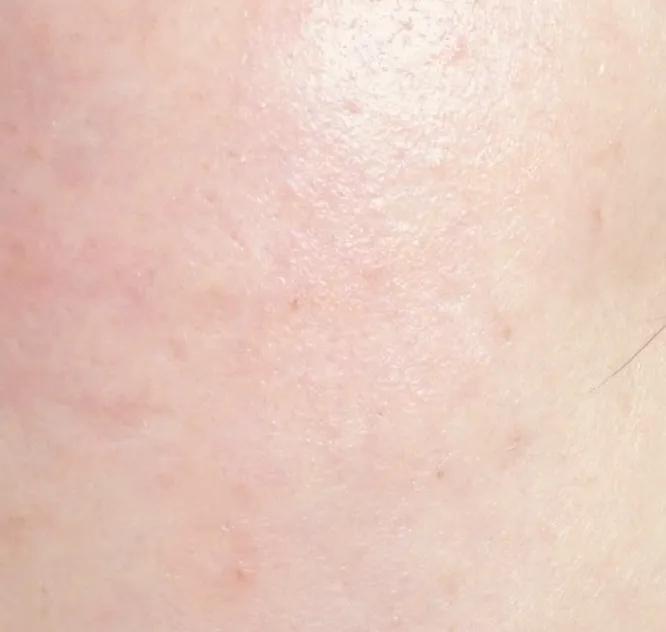 护肤精华液的正确使用方法图解,护肤精华液的正确使用方法步骤