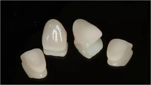 四十多岁门牙缝隙越来越大怎么办,儿童门牙缝隙越来越大原因