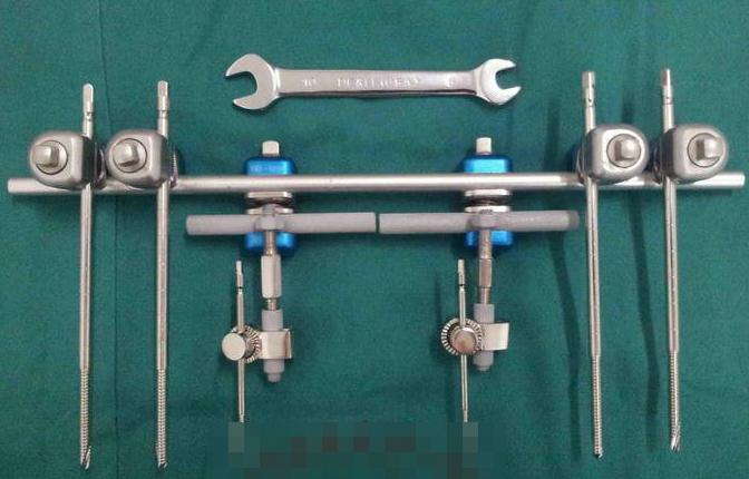 糖尿病足手术后又坏死怎办,糖尿病足部溃烂截肢手术