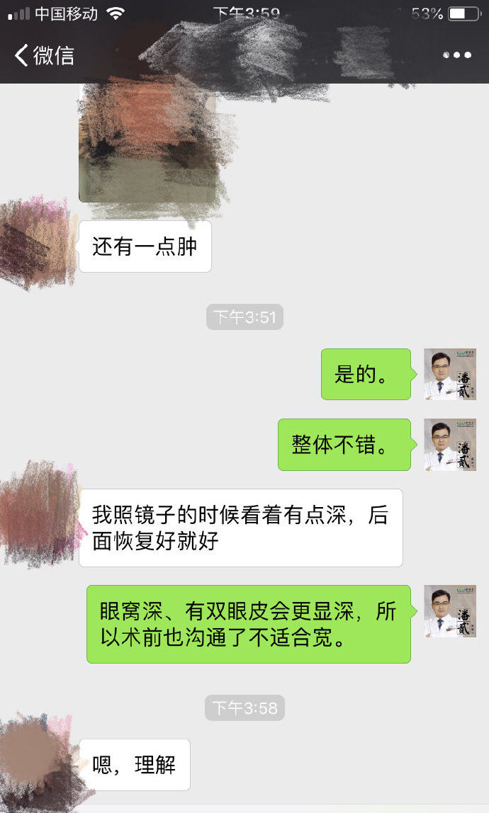 割双眼皮和眉骨有关系吗,做双眼皮想要圆眼割什么样的