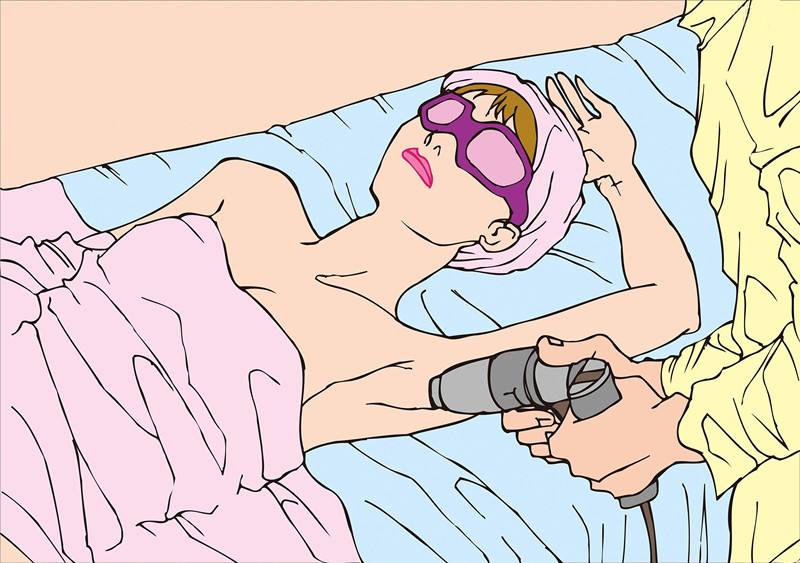 脱毛的实现方式？