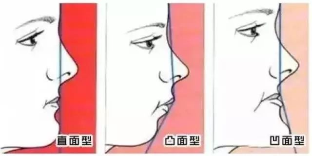 装了假牙以后还会蛀牙吗,装了假牙后可以取下来重新装吗