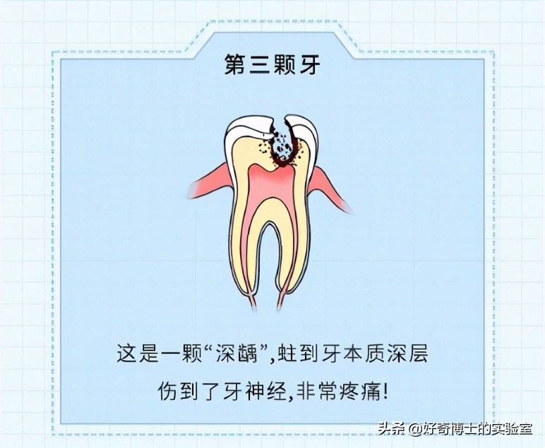 治牙到底有多恐怖,治牙有多痛苦