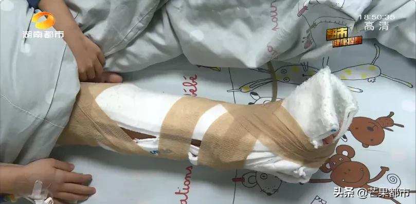 儿童手肘摔伤了一直骨头尖疼,儿童摔伤之后发烧是为什么