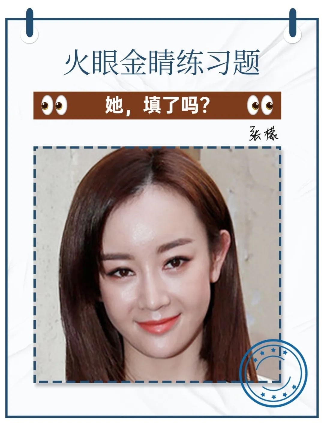 娄艺潇填充脂肪前后对比,娄艺潇填充前后对比