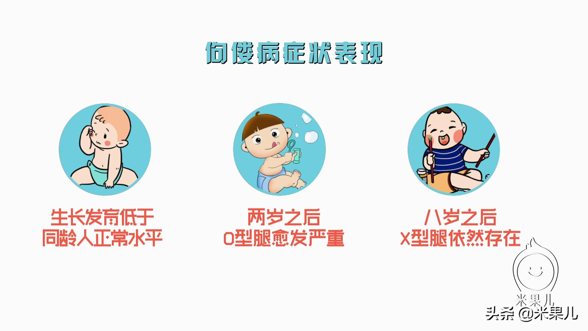 婴儿有o型腿的症状,刚出生婴儿o型腿原因及矫正方法