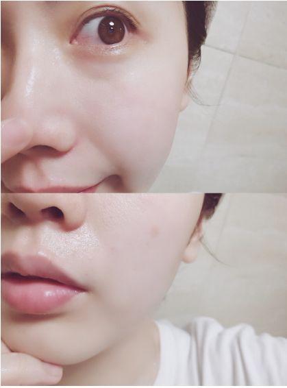 张韶涵澳洲玲珑面膜,张韶涵护肤敏感肌