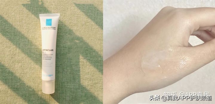 脸上痘痘最简单自愈方法,脸上总是长痘痘心情不好很自卑