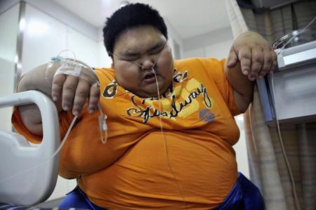 尿酸高急性肾衰竭,慢性肾衰竭尿酸高