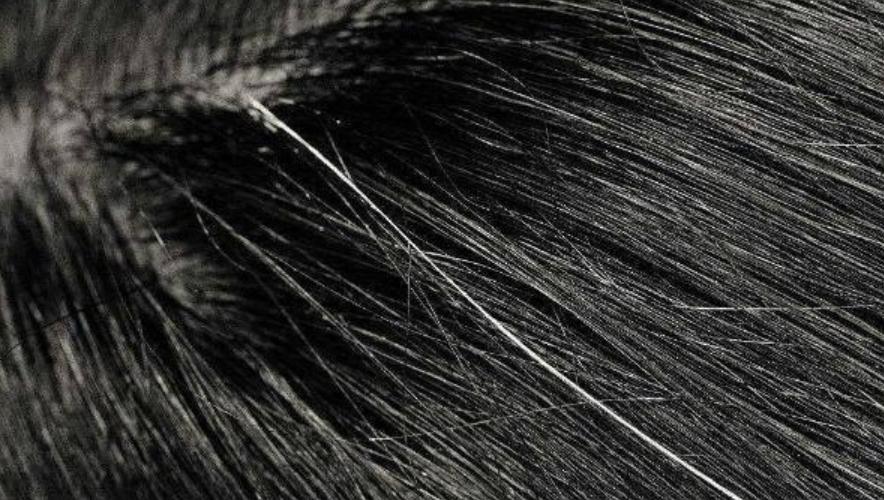 40岁老年人白发染发,40岁出现白发怎么办能拔吗