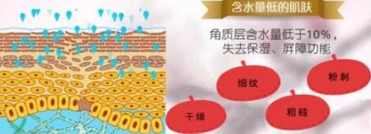 抬头纹太重怎么补救,抬头纹太重怎么改善