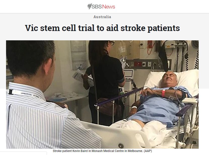 干细胞治疗脑中风效果好吗,干细胞治疗脑中风的最新技术