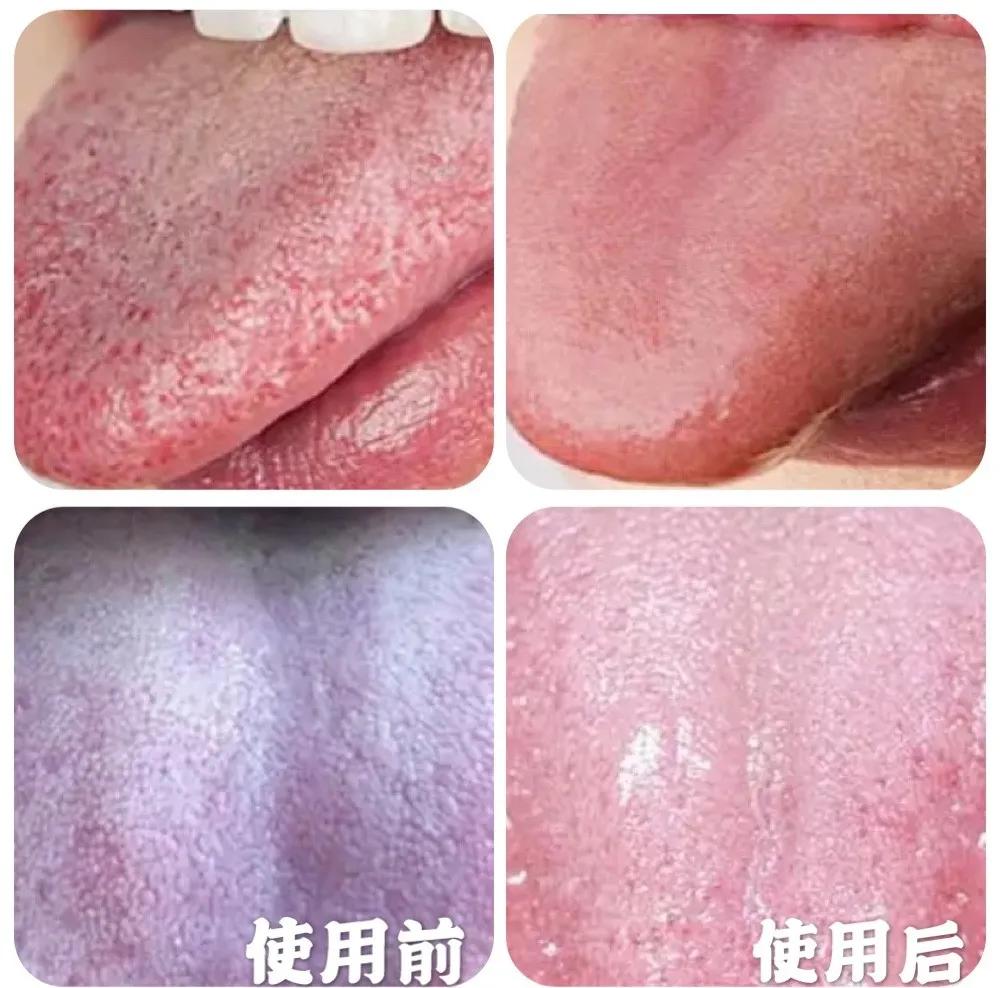 口腔专用香水,能持久留香的口腔香水