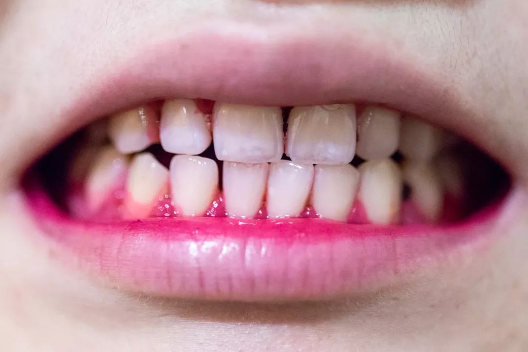 除牙结石美白防口臭的牙膏测评,马卡龙牙膏刷的干净吗