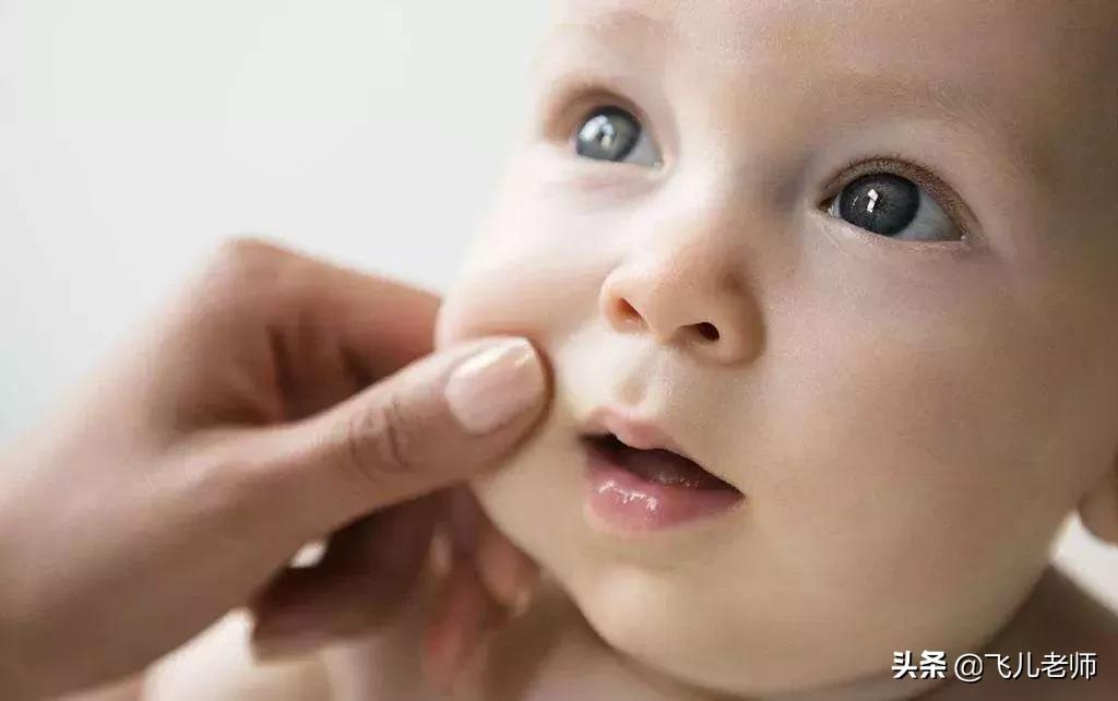 捏宝宝的脸蛋口水会变多吗,宝宝口水疹快速消除小妙招