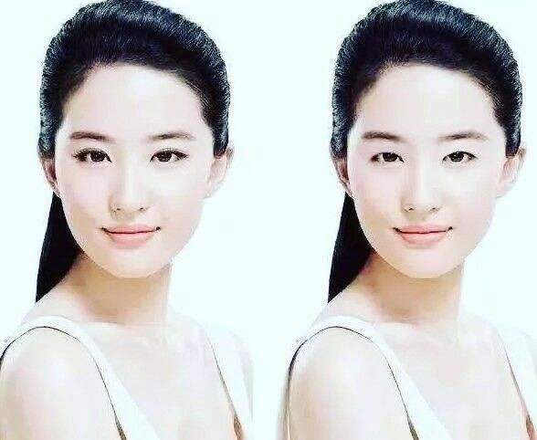 祛眼袋没有卧蚕了,没有卧蚕明星