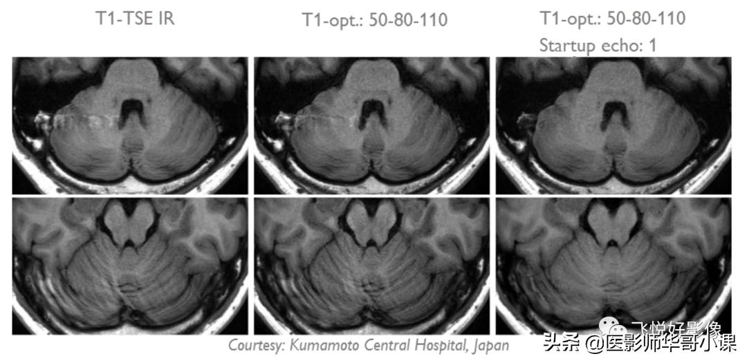 飞利浦磁共振波谱扫描方案,飞利浦1.5t磁共振mri操作使用手册