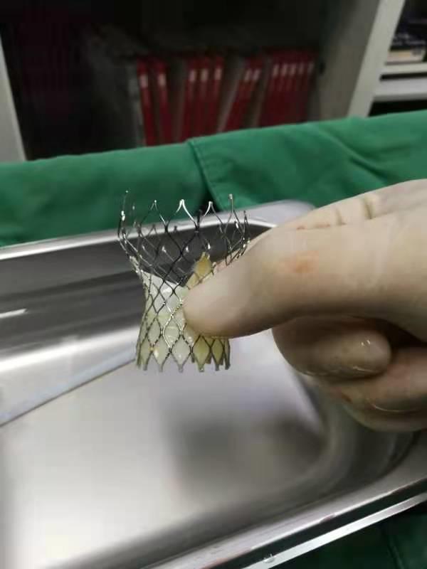 南宁股骨头置换,南宁股骨头置换在哪个医院比较好