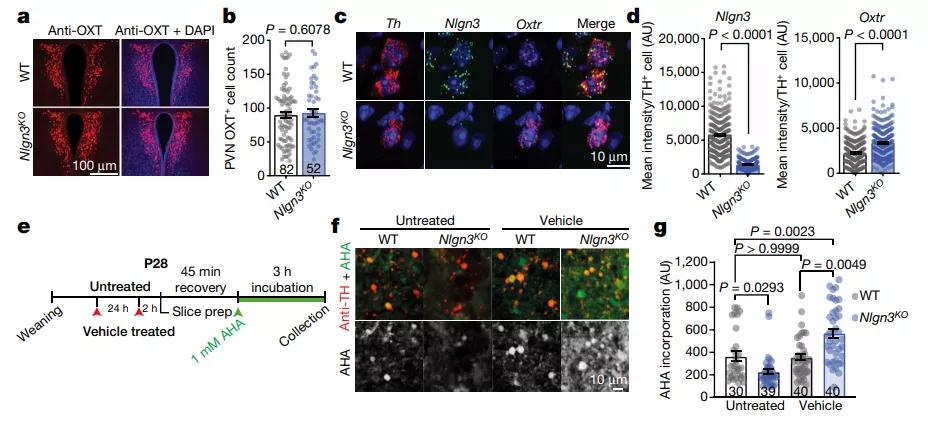 脑科学治自闭症有突破吗,脑科学日报关于记忆