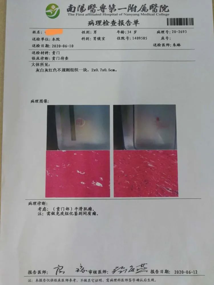 贲门处见隆起性病变,贲门高级别瘤变esd术后不能吃什么