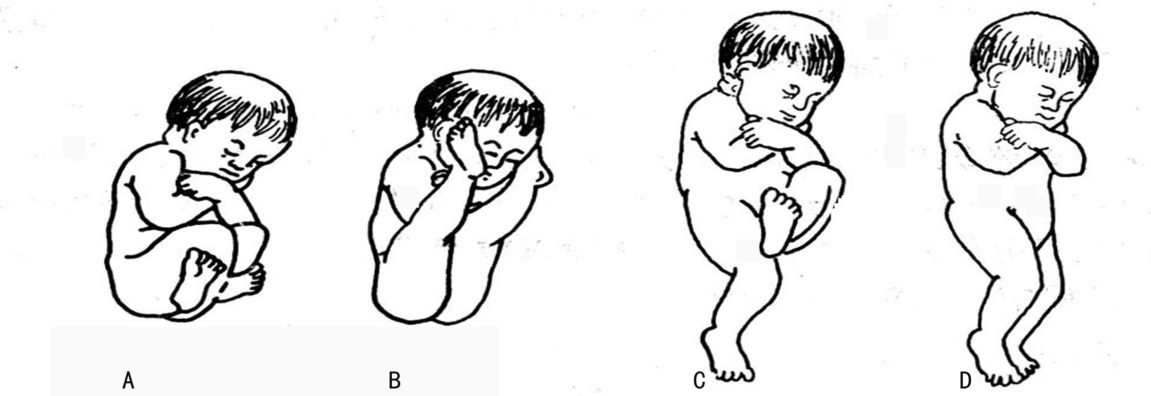 明明白白做超声,十三：胎方位的超声检查