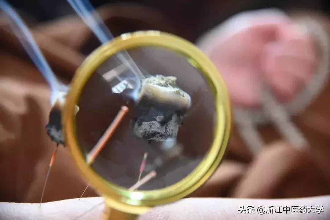 用镜头诉说中医药之美