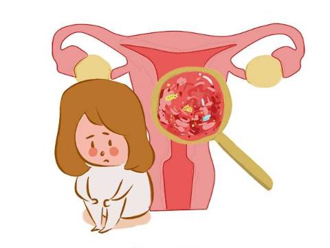 宫颈癌的五大征兆是什么,宫颈癌女人的三个特征