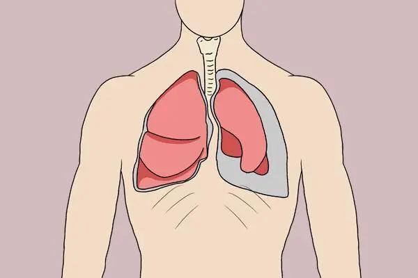 阿莫西林并非万能消炎药!不了解禁忌就乱用,容易伤身体