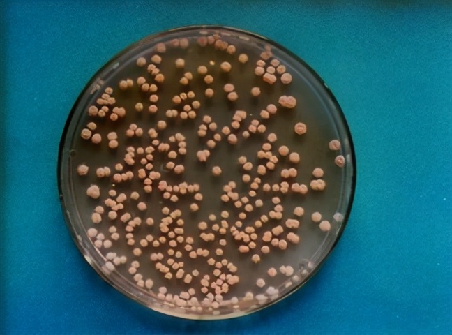 臭氧消灭螨虫的方法,室内除螨虫最有效方法