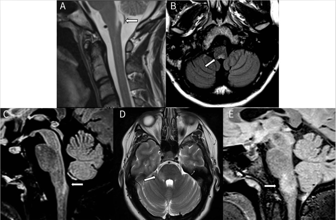 一文读懂13种最常见癌症筛查攻略,一文读懂5大慢性炎症检测项目