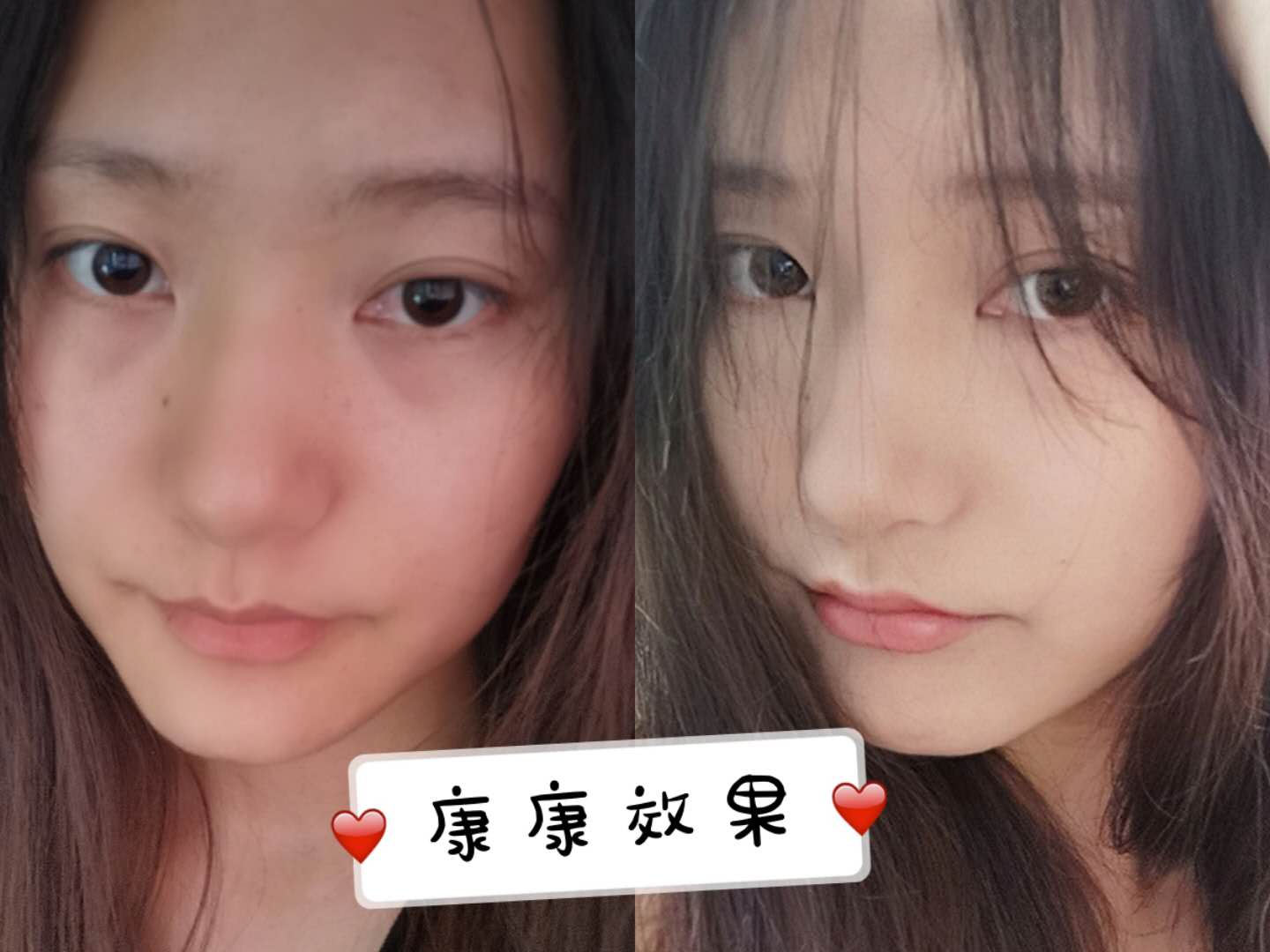 自然光遮泪沟黑眼圈教程,最全黑眼圈泪沟遮瑕大法